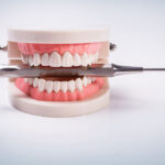 Wybielanie zębów w domu a u dentysty